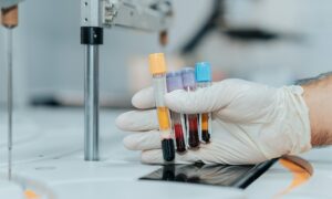 Úgy tűnt, hogy egy mesterséges intelligencia által kifejlesztett gyógyszer biológiailag fiatalabbá tette a betegeket egy klinikai vizsgálat során