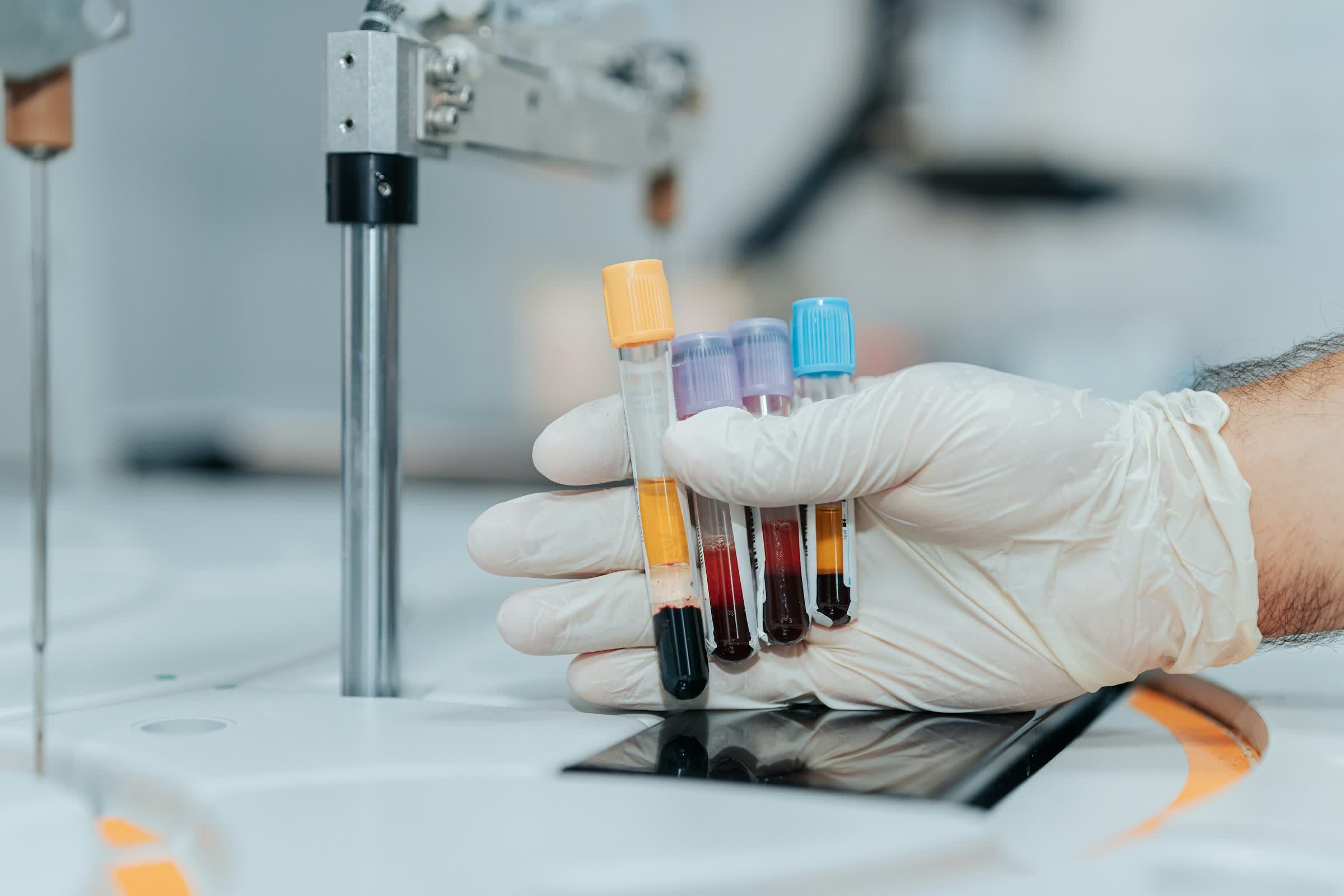 An AI-developed drug appeared to make patients biologically younger in a clinical trial